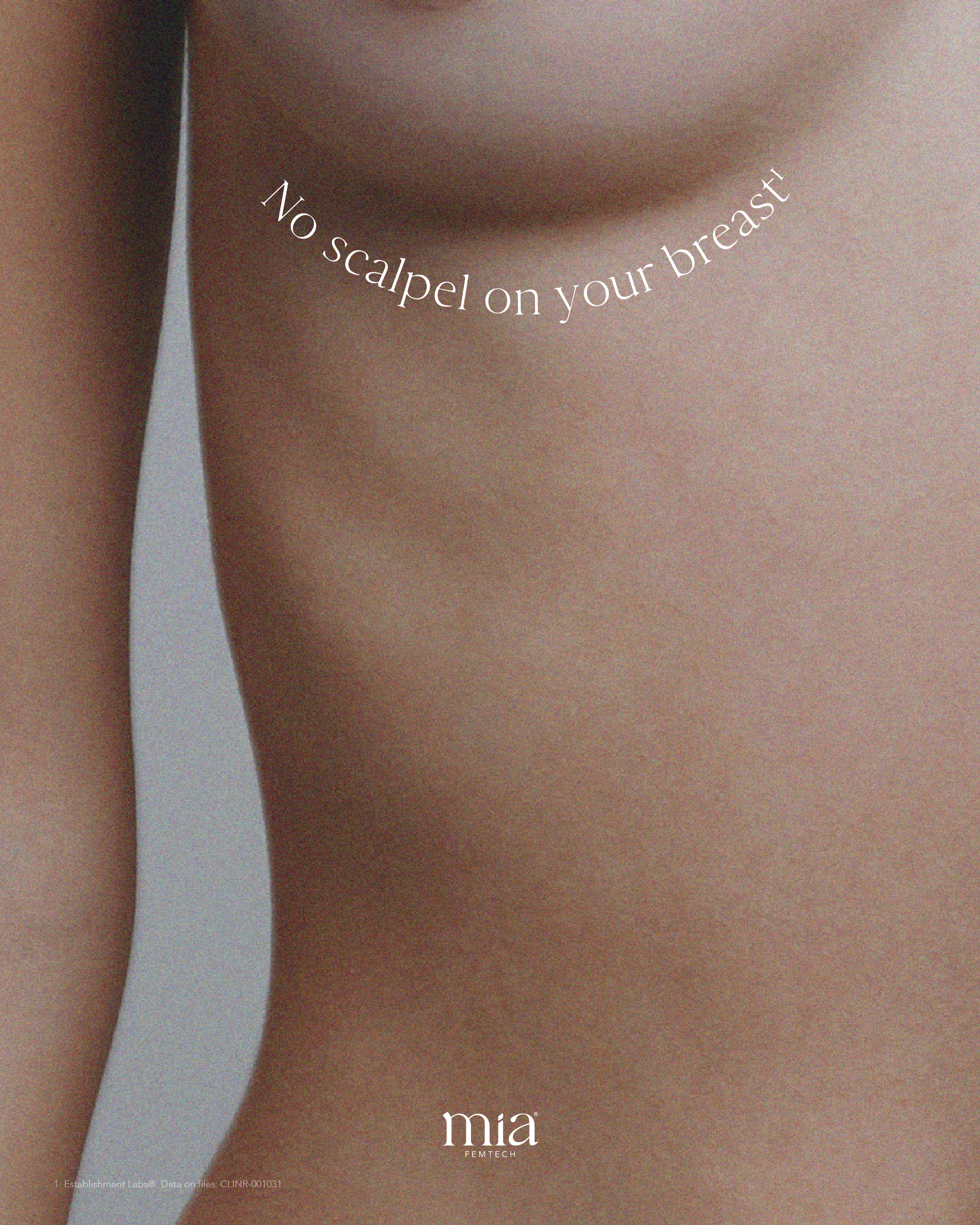 Frau nach Ihrer Brustvergrößerung Mia ohne Narbe an der Brust