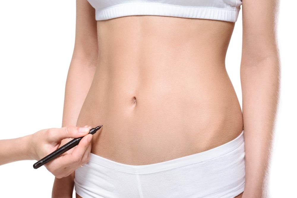 Stift zeigt mögliche Fettpolster am Bauch einer Frau