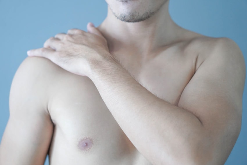 Bei männern brustvergrößerung ᐅ Brustvergrößerung