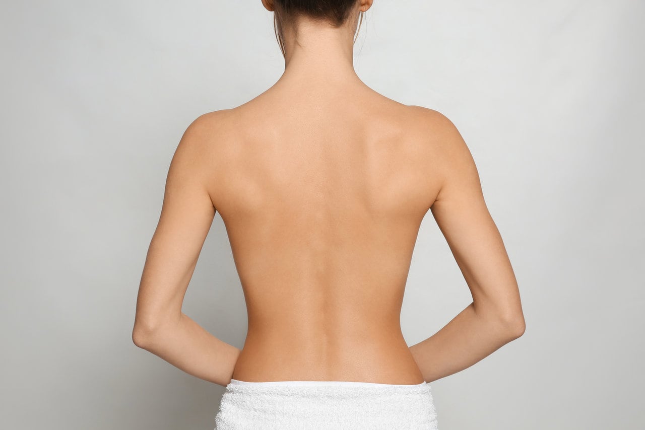 Fettabsaugung Rücken und BH-Zone